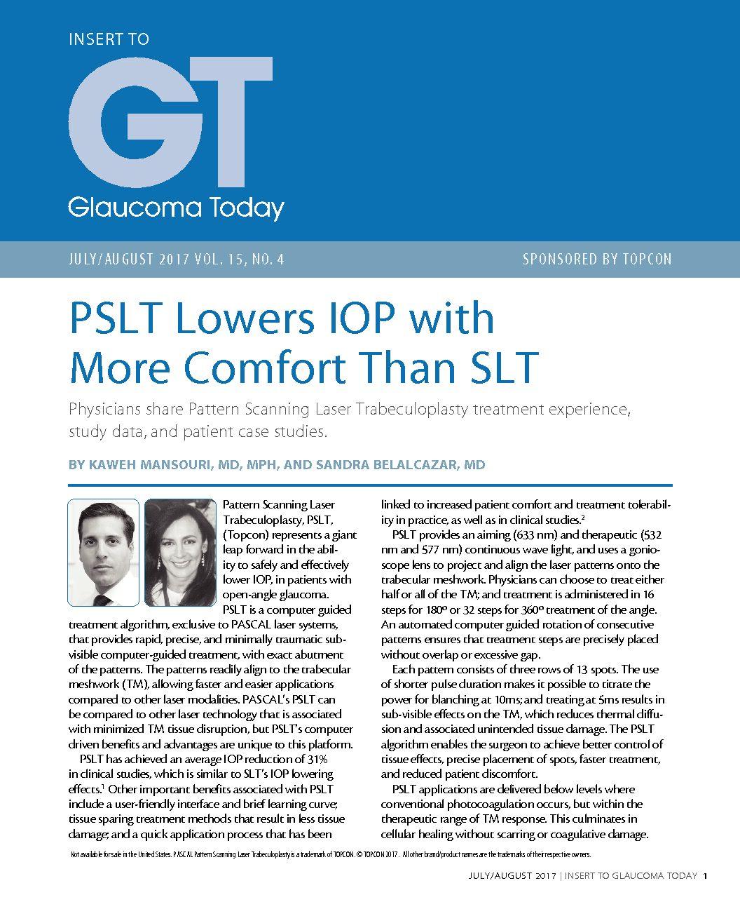 PSLT Lowers IOP with More Comfort Than SLT