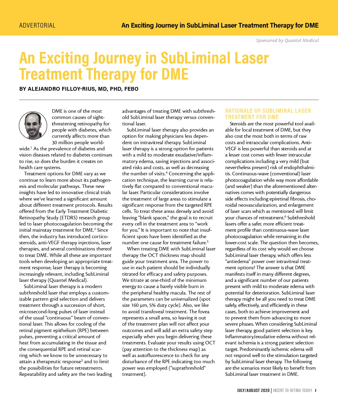 An Exciting Journey in SubLiminal Laser Treatment Therapy for DME